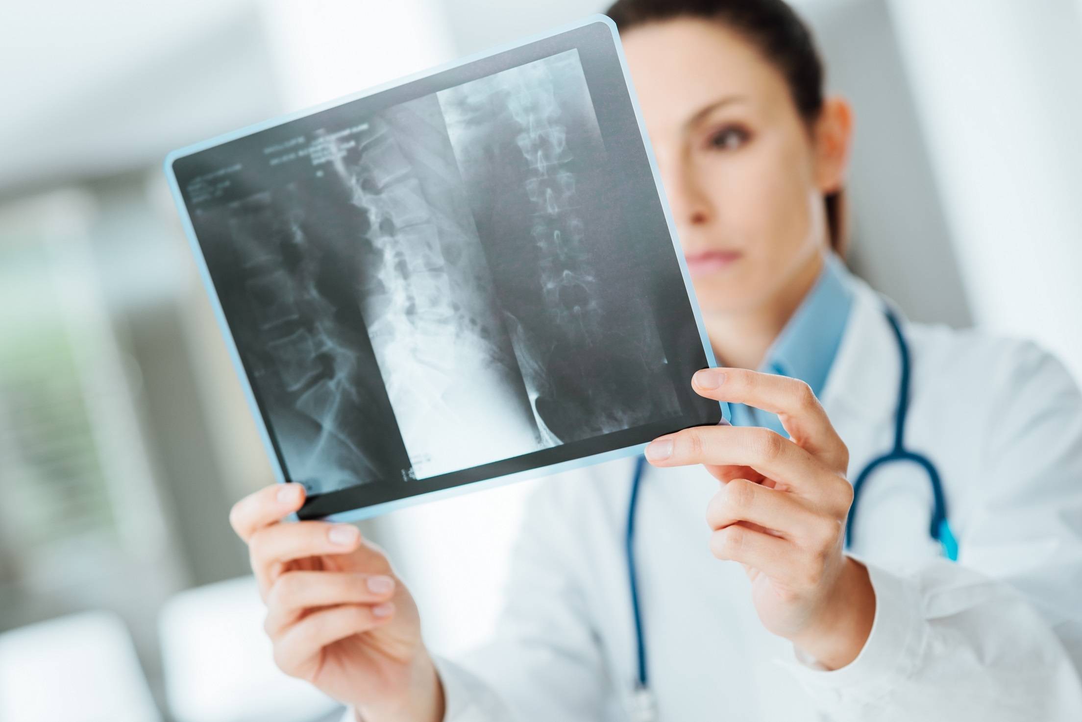 کاربرد اشعه ایکس در پزشکی